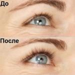 Castor oil vitamin e for eyebrows