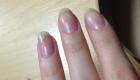 Εύθραυστα και μαλακά νύχια: τι να κάνετε Τα νύχια είναι πολύ απαλή και εύθραυστη θεραπεία